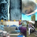 Testimoni Minyak Kutus Kutus Untuk Pasien Pembengkakan Pancreas dan Ginjal