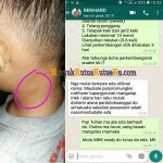 Testimoni Minyak Kutus Kutus Untuk Pembengkakan di Bagian Leher